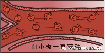 血小板是正常值的三倍？專家提醒小心血栓和出血！