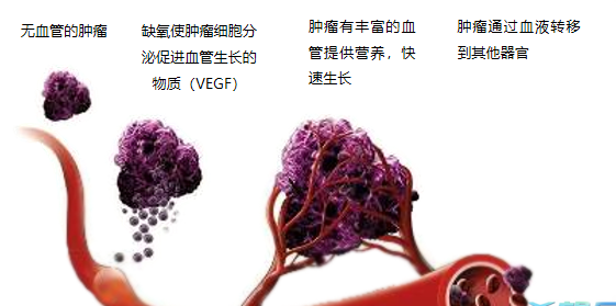 晚期腫瘤為什么會(huì)復(fù)發(fā)轉(zhuǎn)移？