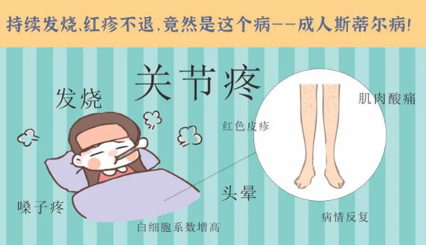 持續(xù)發(fā)燒、紅疹不退……她終于在這里治好了這個罕見病