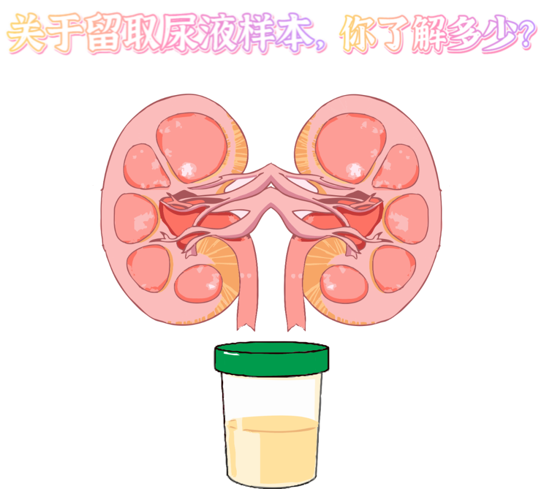 做尿檢，不得不說的注意事項！