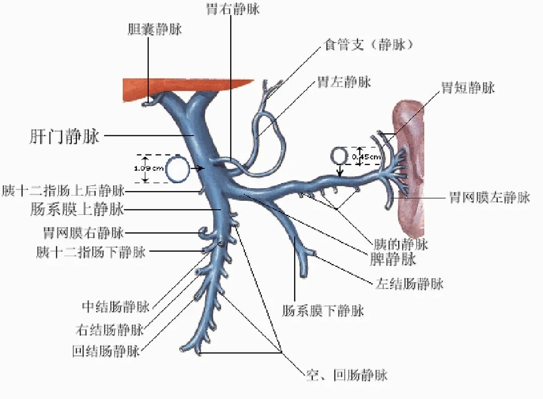 反復嘔血、黑便怎么辦？TIPS手術能解決