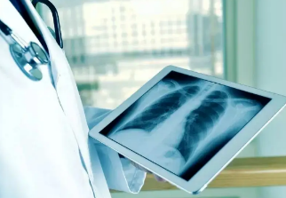 健康呼吸④體檢發(fā)現(xiàn)肺結(jié)節(jié)，我該怎么辦？