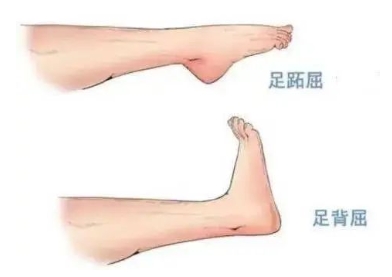 扭胯小連步、動(dòng)感搖花手……“科目三”雖火，運(yùn)動(dòng)損傷也要防！